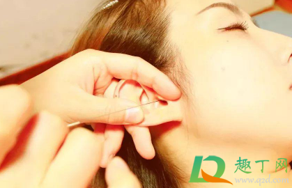 油耳朵怎么掏耳屎(油耳屎用什么掏) 油耳朵怎么掏耳屎(油耳屎用什么掏)