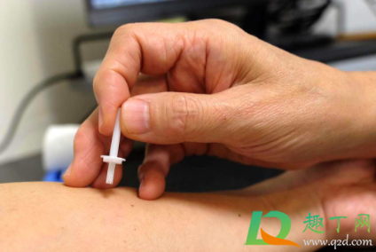 查过敏原在什么科室(去什么科室查过敏源) 查过敏原在什么科室(去什么科室查过敏源)