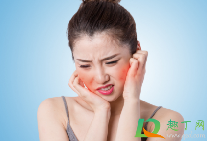 查过敏原麻烦吗(能查出过敏源吗)