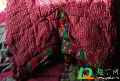 穿棉裤腿毛疼怎么办(穿裤子腿毛疼怎么办) 穿棉裤腿毛疼怎么办(穿裤子腿毛疼怎么办)