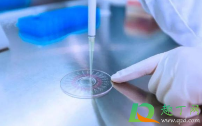 2021春运跨省需要核酸检测吗(2021春运过后跨省是否还核酸检测) 2021春运跨省需要核酸检测吗(2021春运过后跨省是否还核酸检测)