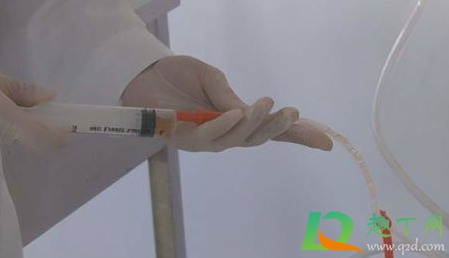 催吐管有什么副作用(催吐管好用吗) 催吐管有什么副作用(催吐管好用吗)