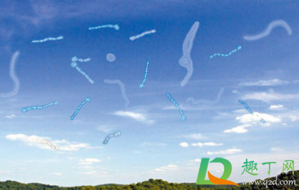 飞蚊症用眼药水能治好吗(飞蚊症用啥眼药水治好) 飞蚊症用眼药水能治好吗(飞蚊症用啥眼药水治好)