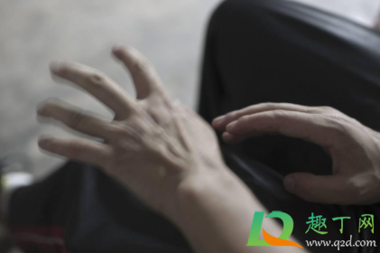 为什么提了重物手抖(提完重物手抖是什么原因) 为什么提了重物手抖(提完重物手抖是什么原因)