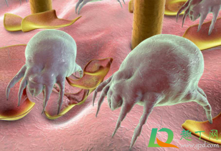 头皮有螨虫用什么可以治(头皮除螨用什么药)