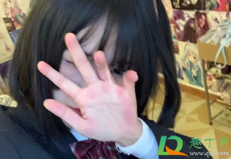 口腔溃疡不是缺维生素(口腔溃疡和缺维生素有关吗)