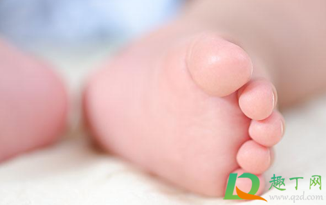 婴儿红斑痣可否自行消退(婴儿鲜红斑痣能彻底治愈吗)