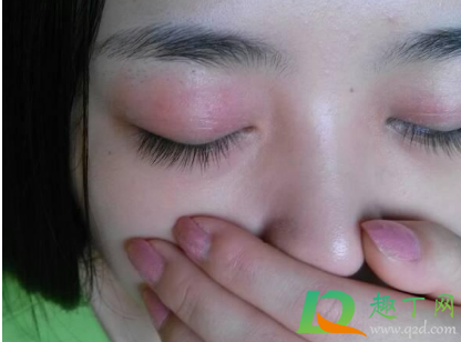 眼皮发痒红肿是咋回事(眼皮痒还红肿是怎么回事)