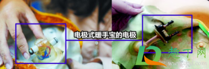 哪种暖手宝最安全(暖手宝种类安全) 哪种暖手宝最安全(暖手宝种类安全)