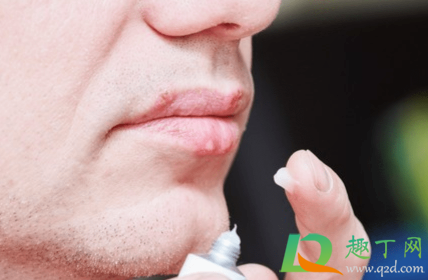 嘴唇老是干燥想舔是上火了吗(嘴唇干一直想舔嘴唇是什么原因) 嘴唇老是干燥想舔是上火了吗(嘴唇干一直想舔嘴唇是什么原因)