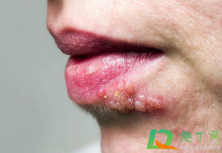 嘴唇老是干燥想舔是上火了吗(嘴唇干一直想舔嘴唇是什么原因)