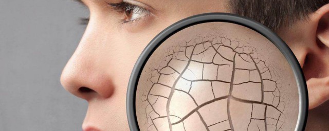 是由什么导致的(肾炎是由什么导致的)