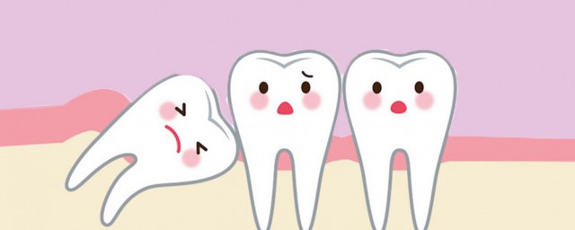 智齿会痛吗(拔完智齿会痛吗)