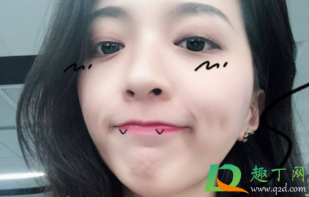 全切双眼皮能管一辈子吗(全切双眼皮谁做谁后悔)