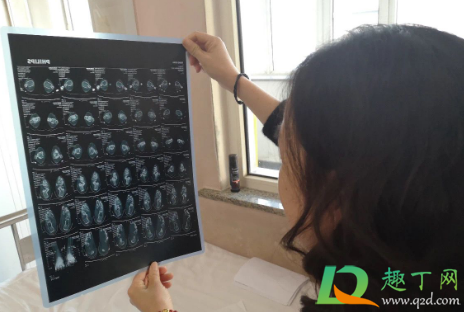 布病现在是转阴了还用吃药吗(布病转阴了算是痊愈吗)