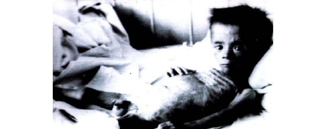 营养不良会使皮肤出现黑斑点吗(皮肤出现黑色斑点是什么原因)