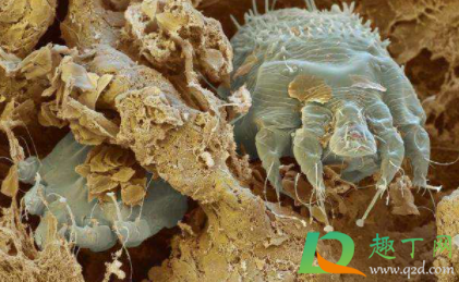 怎么让身上没有螨虫(怎么去除身体上的螨虫)