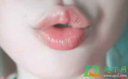嘴角裂口可以舔吗(嘴角干裂可以舔吗)