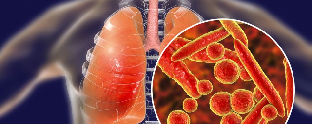 得了肺炎饮食上应该这样调理(得了肺炎饮食注意什么)