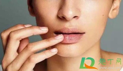 嘴角裂口可以舔吗(嘴角干裂可以舔吗)