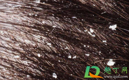 头皮长痘可以擦红霉素吗(头皮长痘可以涂红霉素软膏吗) 头皮长痘可以擦红霉素吗(头皮长痘可以涂红霉素软膏吗)