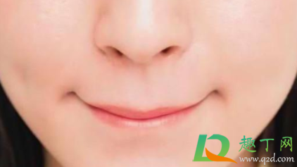嘴角裂口会自己好吗(嘴角总裂口有什么好办法)