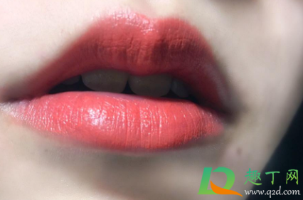 嘴角裂口会不会传染(嘴唇干裂会传染吗) 嘴角裂口会不会传染(嘴唇干裂会传染吗)