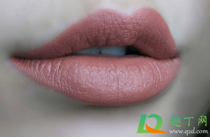 嘴角裂口会不会传染(嘴唇干裂会传染吗)