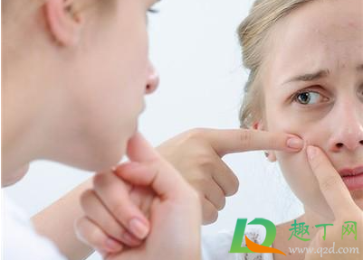 挤痘痘为什么会变黑色(为什么挤过的痘痘会变黑) 挤痘痘为什么会变黑色(为什么挤过的痘痘会变黑)