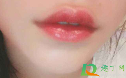 嘴角干裂口缺什么维生素(嘴干裂口子缺什么维生素)