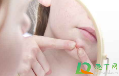 挤痘痘为什么会变黑色(为什么挤过的痘痘会变黑) 挤痘痘为什么会变黑色(为什么挤过的痘痘会变黑)