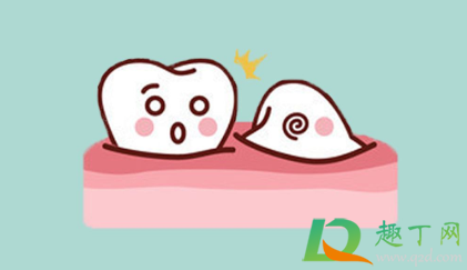 智齿横着长拔牙有风险吗(智齿横生拔牙有危险吗) 智齿横着长拔牙有风险吗(智齿横生拔牙有危险吗)