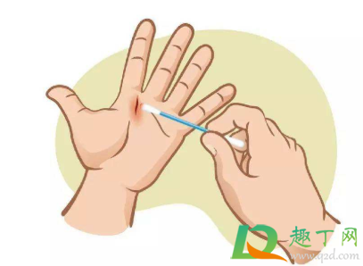 一点点擦伤怎么处理(擦伤的常见处理方法一点一滴) 一点点擦伤怎么处理(擦伤的常见处理方法一点一滴)