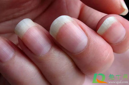 指甲里有白色斑块是为什么(大拇指指甲里有白色斑块是为什么)