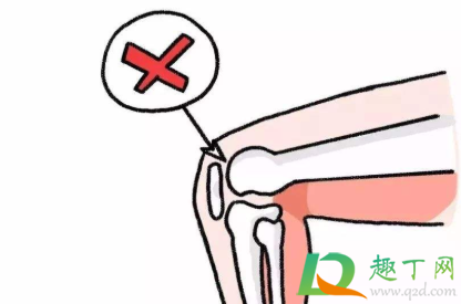 膝盖骨折要打钢钉吗(骨折了需要打钢钉吗) 膝盖骨折要打钢钉吗(骨折了需要打钢钉吗)