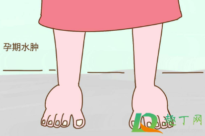 怀孕脚脖子肿了应该冷敷还是热敷(脚脖子肿了是热敷还是冷敷)