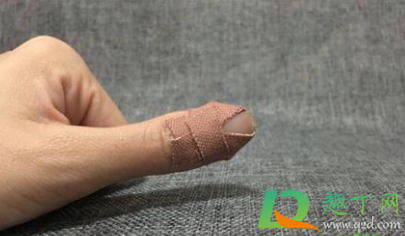 一点点擦伤怎么处理(擦伤的常见处理方法一点一滴) 一点点擦伤怎么处理(擦伤的常见处理方法一点一滴)