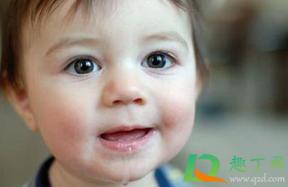 擦伤可以用口水消毒吗(口水有消毒作用吗可以弄伤口) 擦伤可以用口水消毒吗(口水有消毒作用吗可以弄伤口)