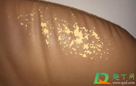 皮椅子掉皮在家怎么自行处理(皮质椅子掉皮如何处理) 皮椅子掉皮在家怎么自行处理(皮质椅子掉皮如何处理)