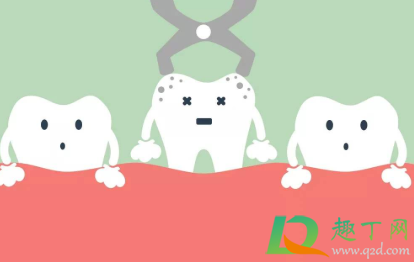 拔牙怎么消肿脸部(拔牙脸肿如何快速消肿)