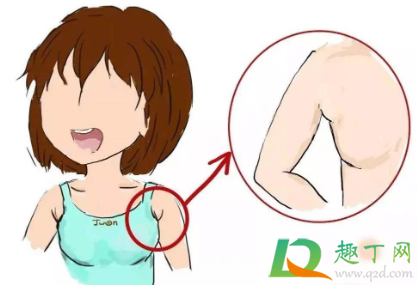 胳肢窝痒怎么解决(胳肢窝特别痒怎么办)