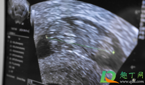 什么提示你怀了男宝宝(孕早期什么提示你怀了男宝宝)