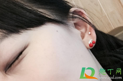 耳后窝酸痛是怎么回事(耳朵后面窝窝疼是怎么回事) 耳后窝酸痛是怎么回事(耳朵后面窝窝疼是怎么回事)