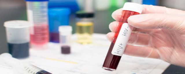 艾滋病核酸检测的介绍(艾滋病的核酸检测方法)