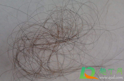 头发被扯掉了毛囊还会长吗(毛囊拽掉了还能长头发吗)