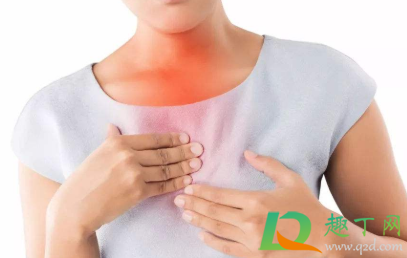 有点烧心怎么立即能好(怎么可以缓解烧心) 有点烧心怎么立即能好(怎么可以缓解烧心)