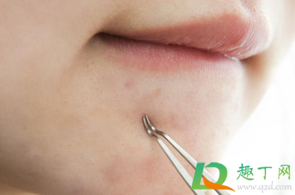 痘痘出血止不住怎么快速止血(痘痘破了血止不住怎么办) 痘痘出血止不住怎么快速止血(痘痘破了血止不住怎么办)