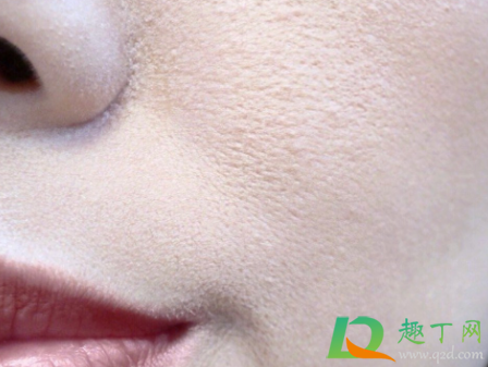 嘴角卡粉起皮怎么办(嘴唇上面卡粉怎么办) 嘴角卡粉起皮怎么办(嘴唇上面卡粉怎么办)