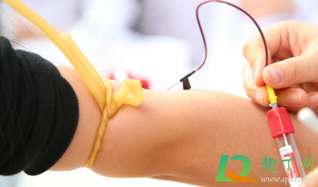 无创dna是检查费用大概多少钱(郑州无创dna是检查费用大概多少钱)