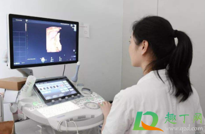 b超单子怎么看男女(40天b超单子怎么看男女)